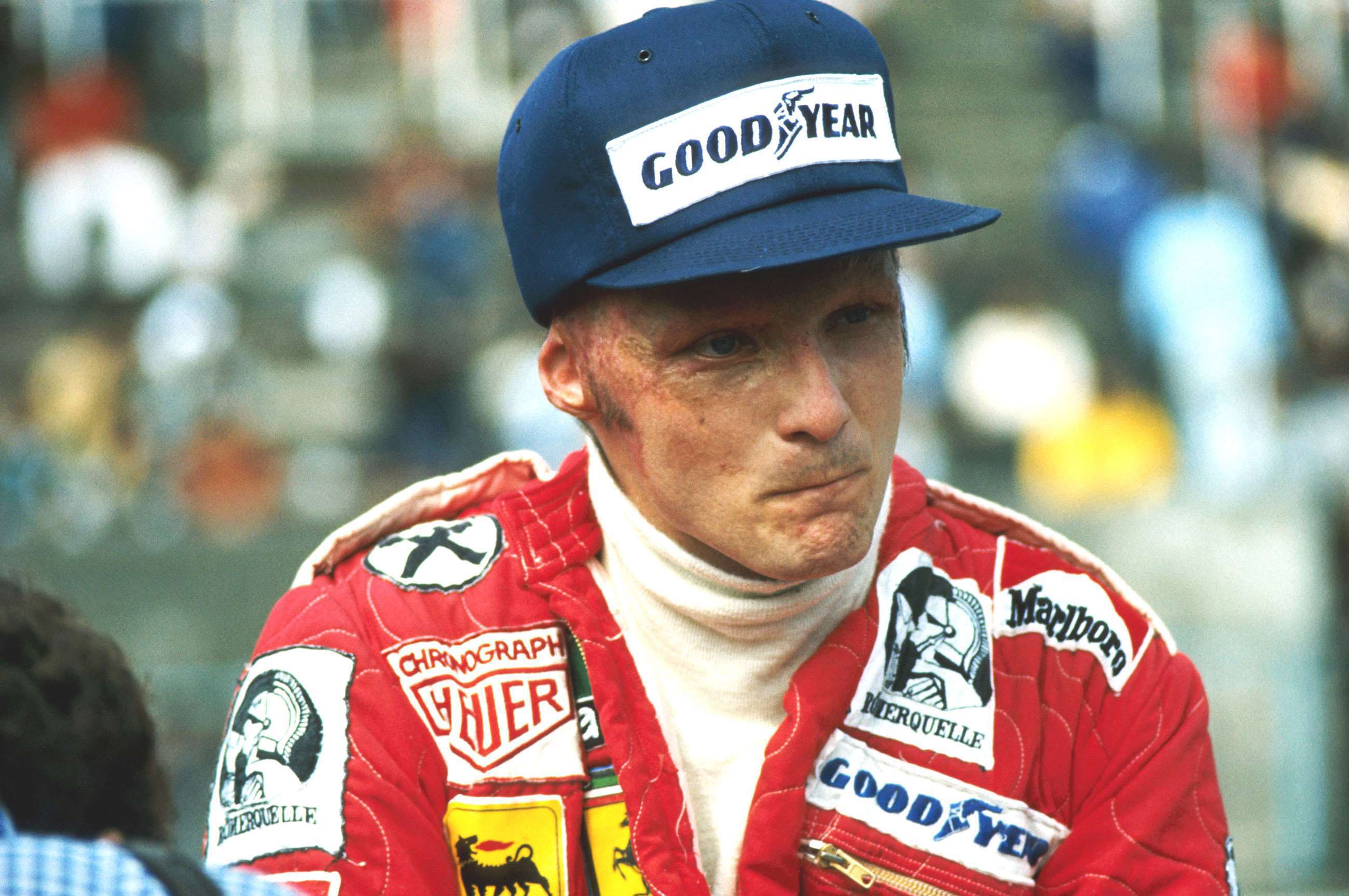 greatest-motorsport-injury-recoveries-2-niki-lauda-f1-1976-monza-david-phipps-mi-17022022.jpg